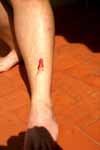 CR99_Wound1_s.jpg (5156 bytes)