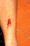 CR99_Wound2_s.jpg (4587 bytes)